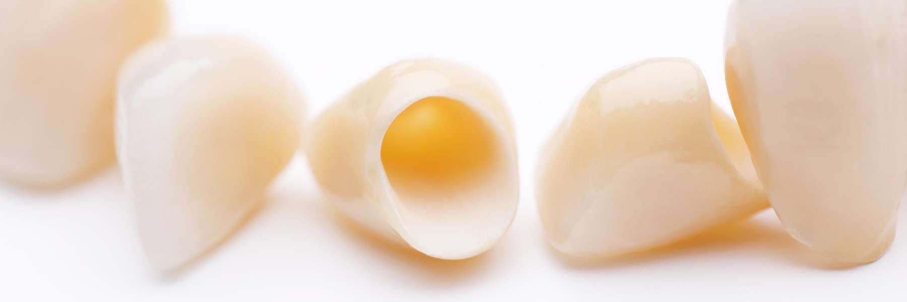dental crowns paducah ky